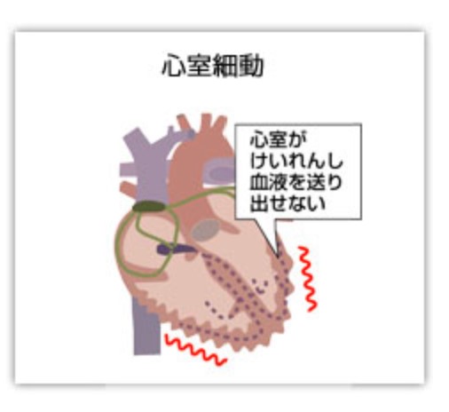 心臓を貫かれて