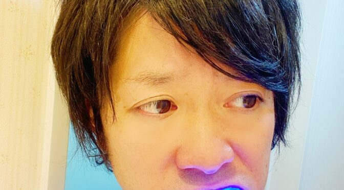 【雑談】歯のホワイトニングに挑戦！